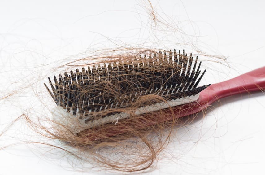 quais sao os tipos de perda de cabelo