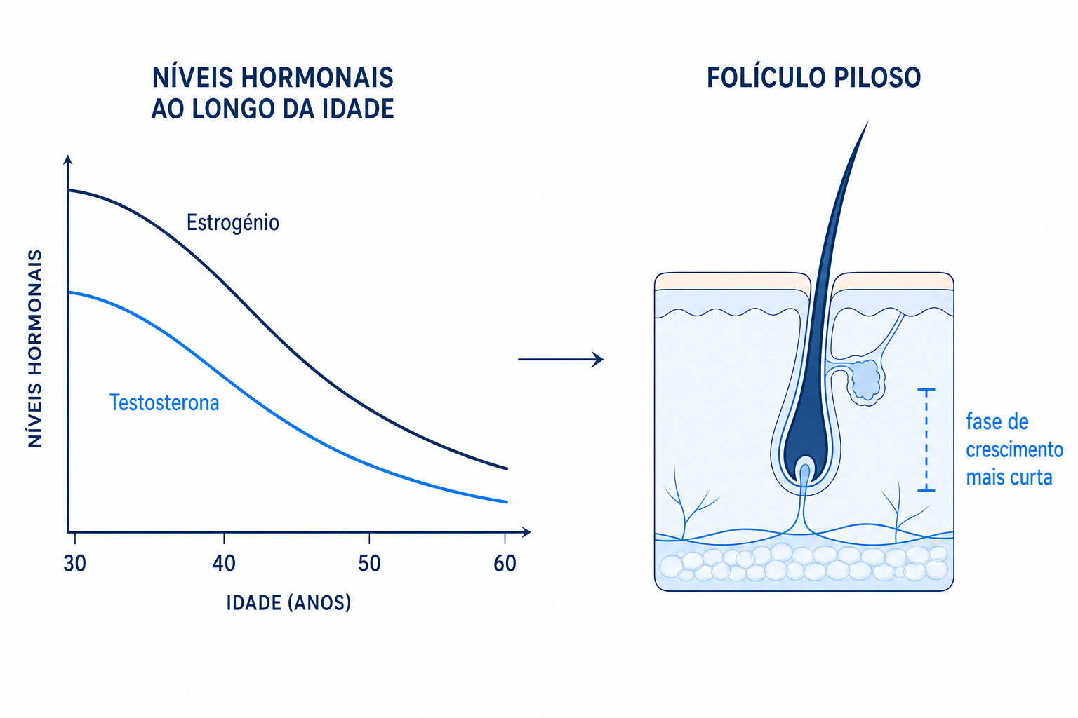 Infografia: descida dos níveis de estrogénio e testosterona e o seu efeito no folículo piloso com a idade