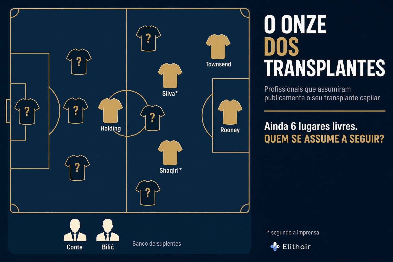 Infografia: o onze dos transplantes, profissionais com transplante capilar assumido publicamente no quadro táctico