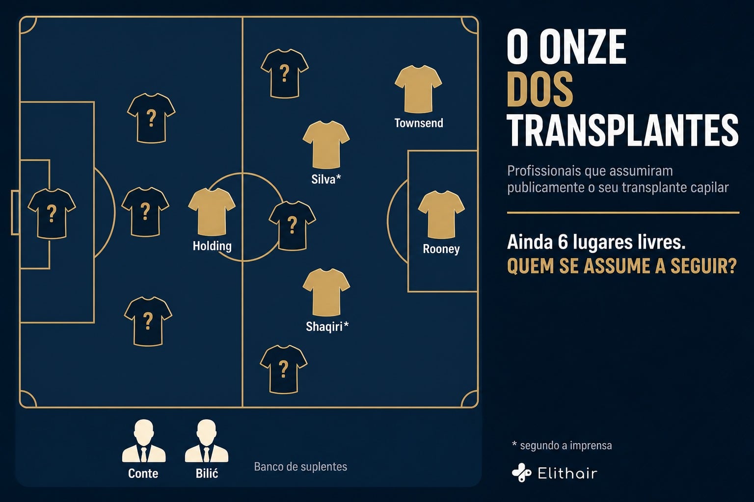 Infografia: o onze dos transplantes, profissionais com transplante capilar assumido publicamente no quadro táctico
