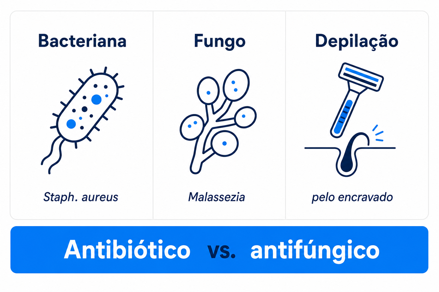 Comparação dos três tipos mais frequentes de foliculite: bacteriana, por fungo e por depilação