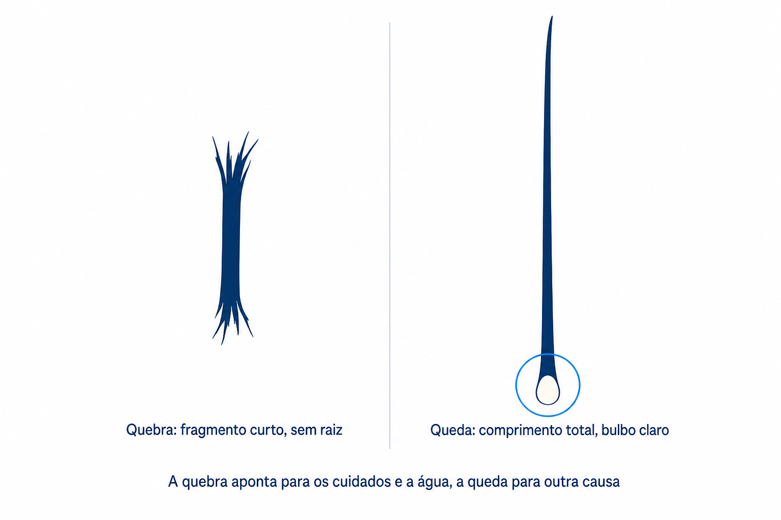 Ilustração: cabelo partido sem raiz em comparação com cabelo caído com bulbo claro na base