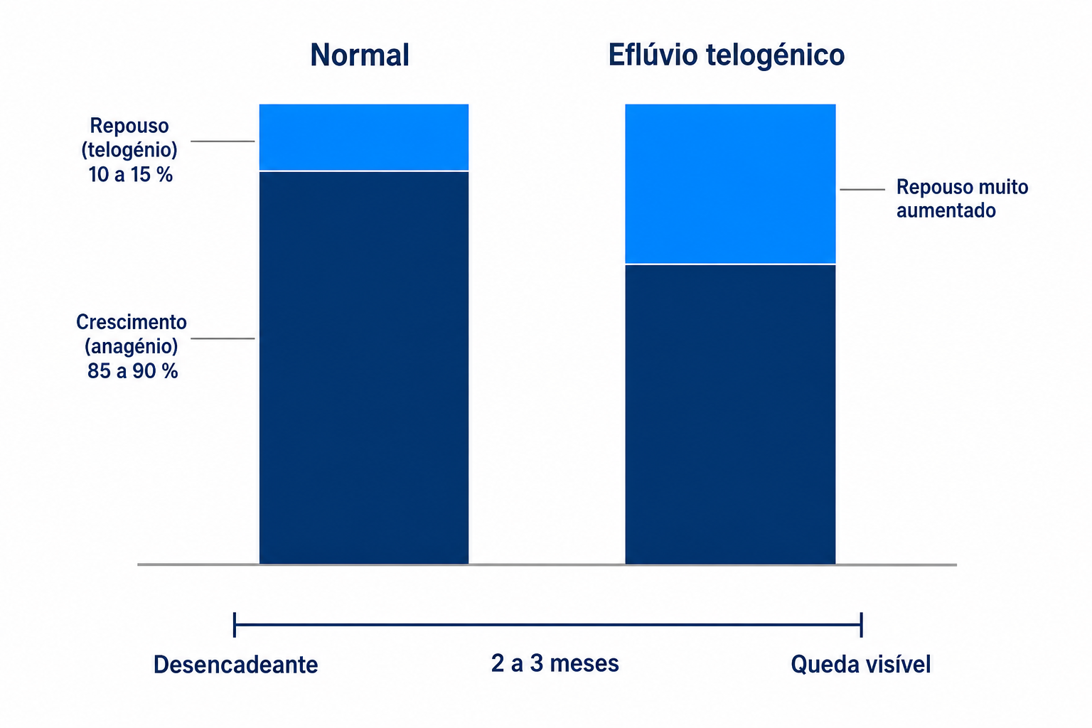 Diagrama: ciclo capilar normal com 85 a 90 por cento de fase de crescimento em comparação com a fase de repouso aumentada no eflúvio telogénico