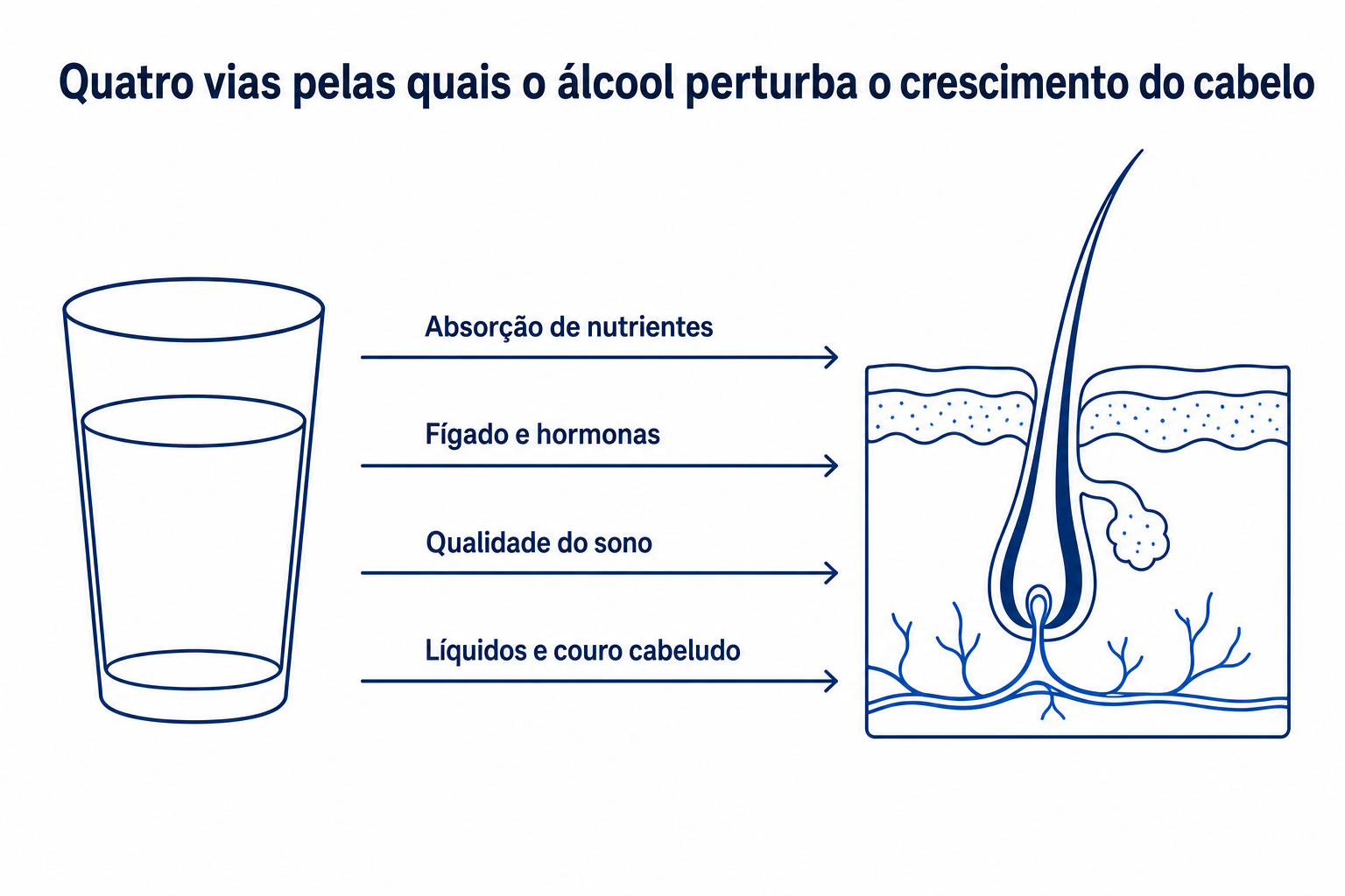 Infografia: quatro vias pelas quais o álcool perturba o crescimento do cabelo, da absorção de nutrientes ao couro cabeludo