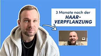 Bild zeigt Elithair Patienten John B. 3 Monate nach seiner Haartransplantation