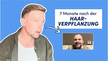 Bild zeigt Elithair Patienten John B. 7 Monate nach seiner Haartransplantation