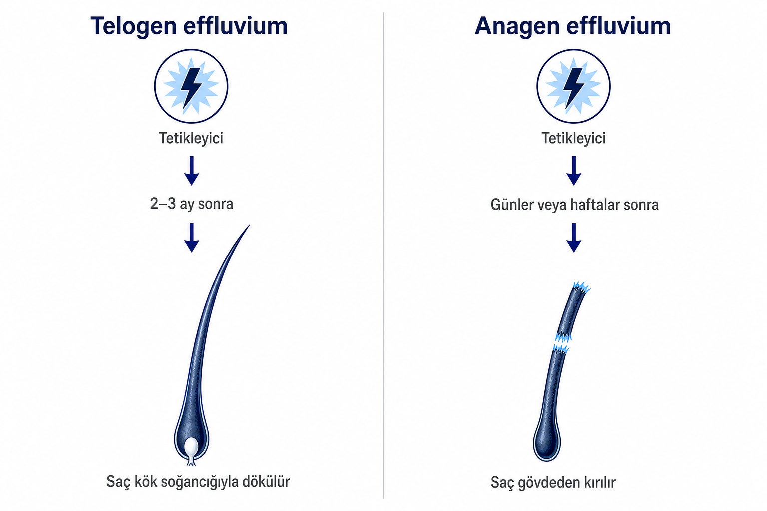 İnfografik: telogen effluviumda soğancığıyla dökülen saç ile anagen effluviumda kırılan saç gövdesinin karşılaştırması