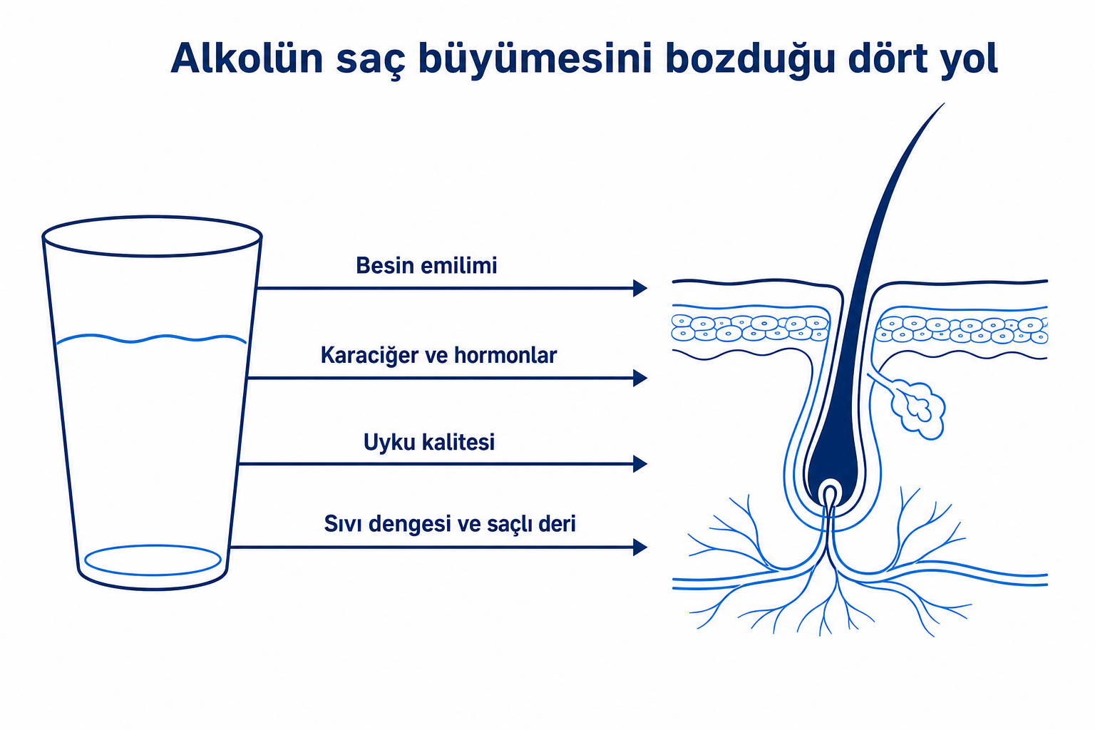 İnfografik: alkolün saç büyümesini bozduğu dört yol, besin emiliminden saçlı deriye