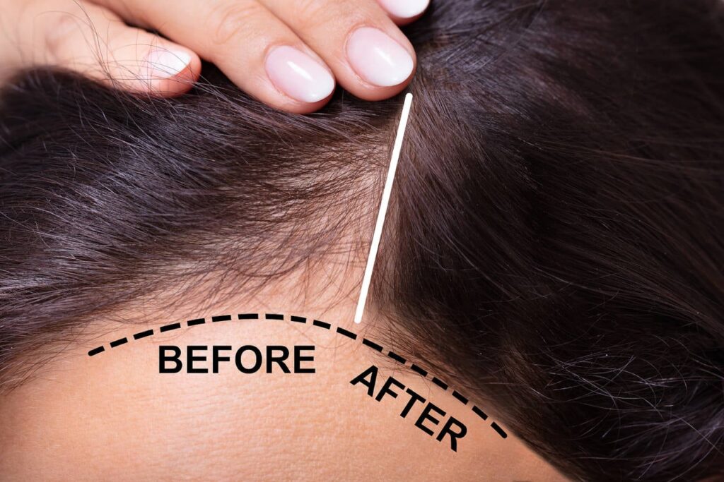 a pull test is the best way to check if your hair loss is getting out of hand