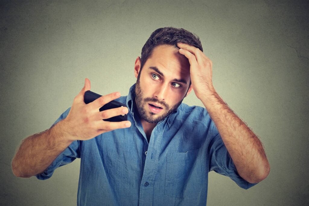 A distressed man suffering from androgenetic alopecia examines his receding hairline in the front-facing camera of his phone.
