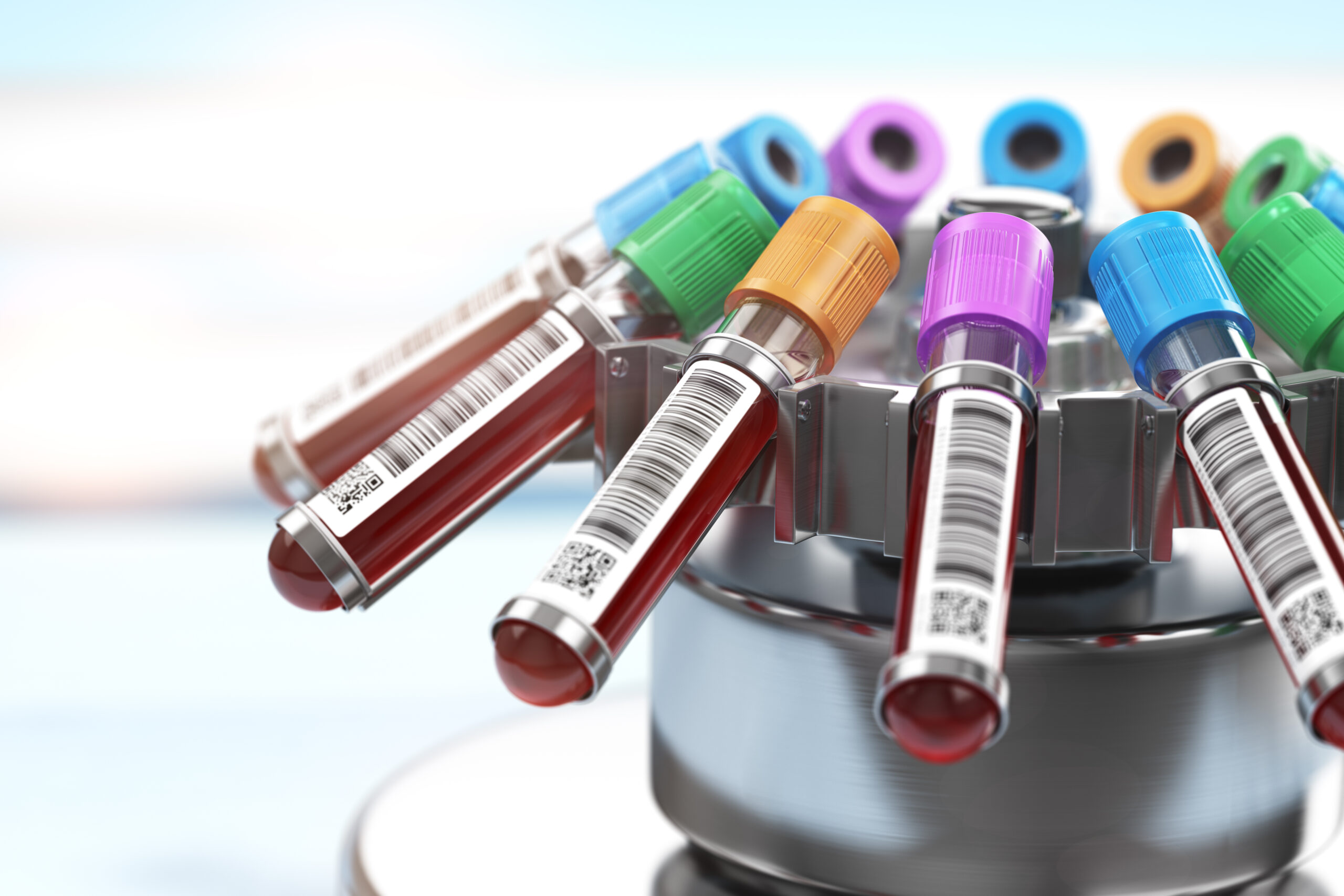 Centrifuge with test tubes containing blood