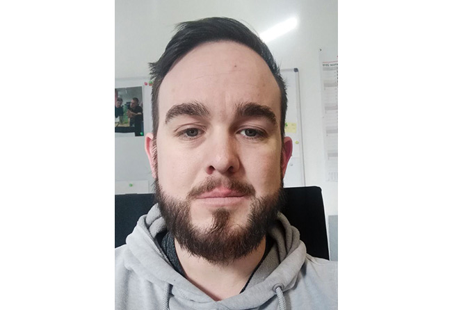 Image result beard implant sapphire 4300 grafts oliver georg dyllick
