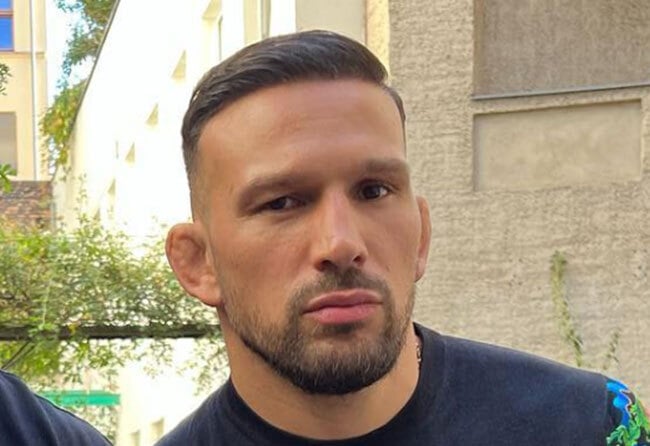 Picture of Max C, an Elithair patient, showing the result of his hair transplant with 3250 grafts