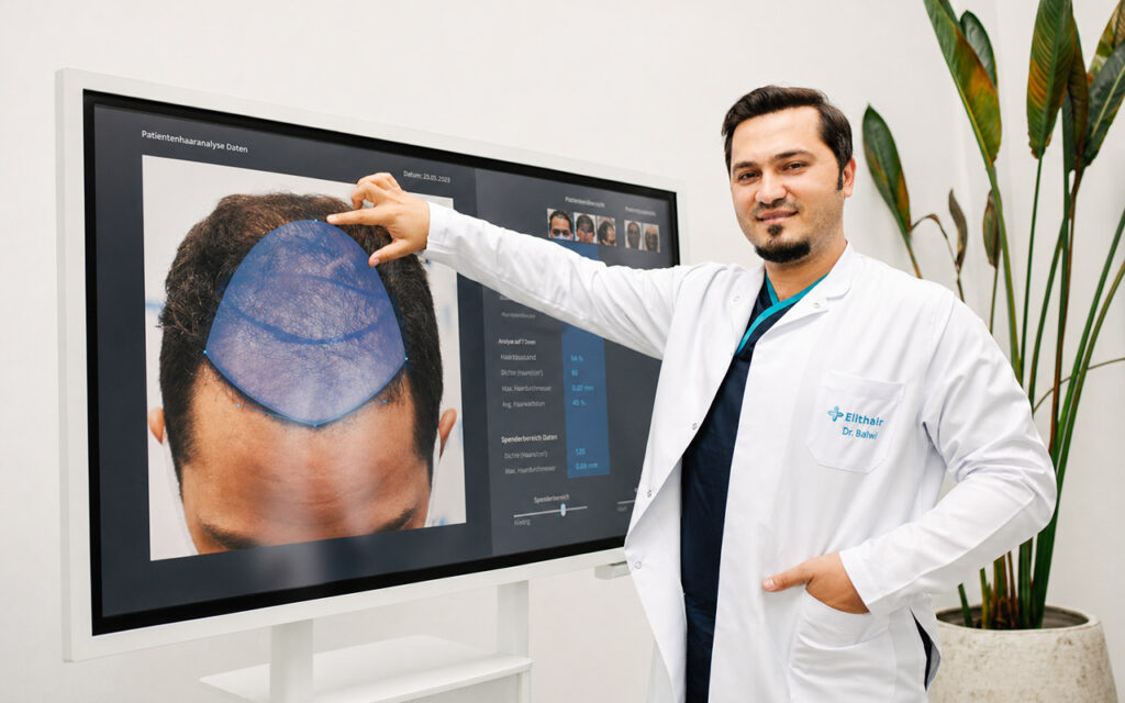 Dr. Balwi reviewing digital hair analysis results on a screen to assess hair loss and plan treatment