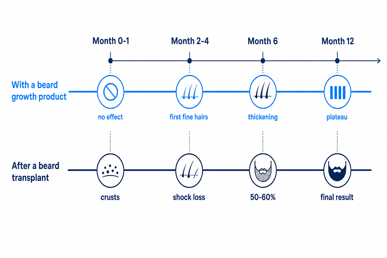 Timeline infographic of beard growth with a beard growth product compared to a beard transplant from month 0 to 12