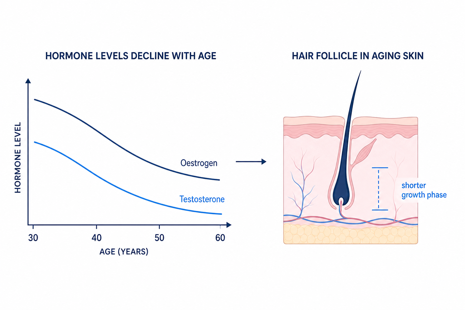 Infographic: declining oestrogen and testosterone levels and their effect on the hair follicle with age