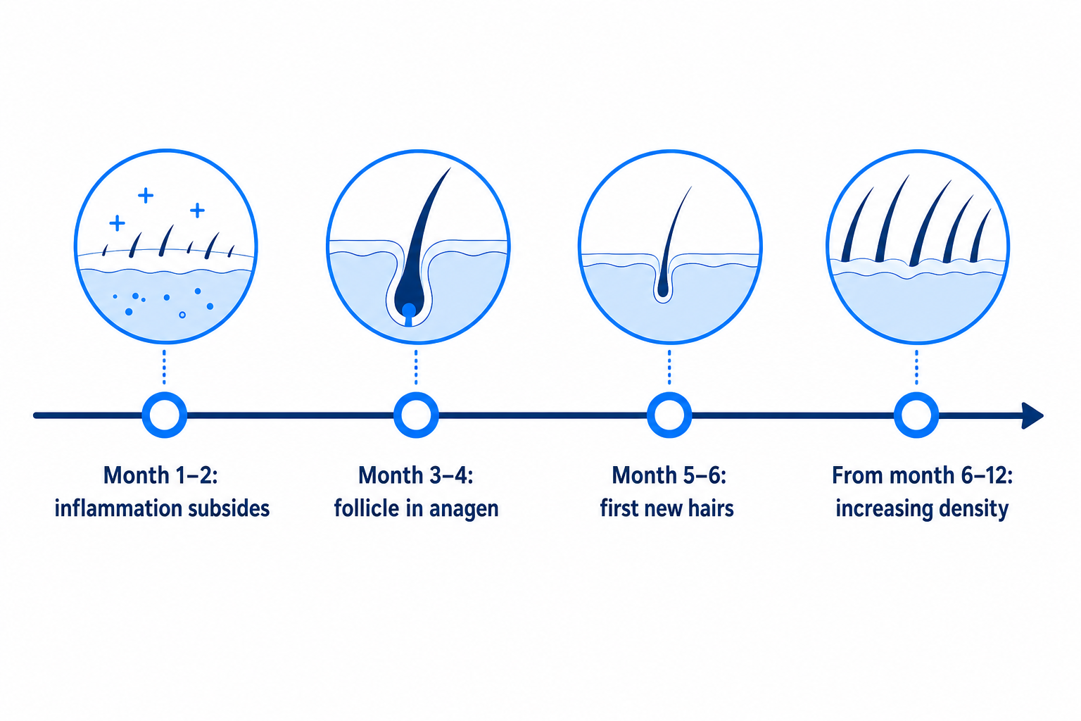 Timeline: hair regrowth after successful corticosteroid therapy over twelve months