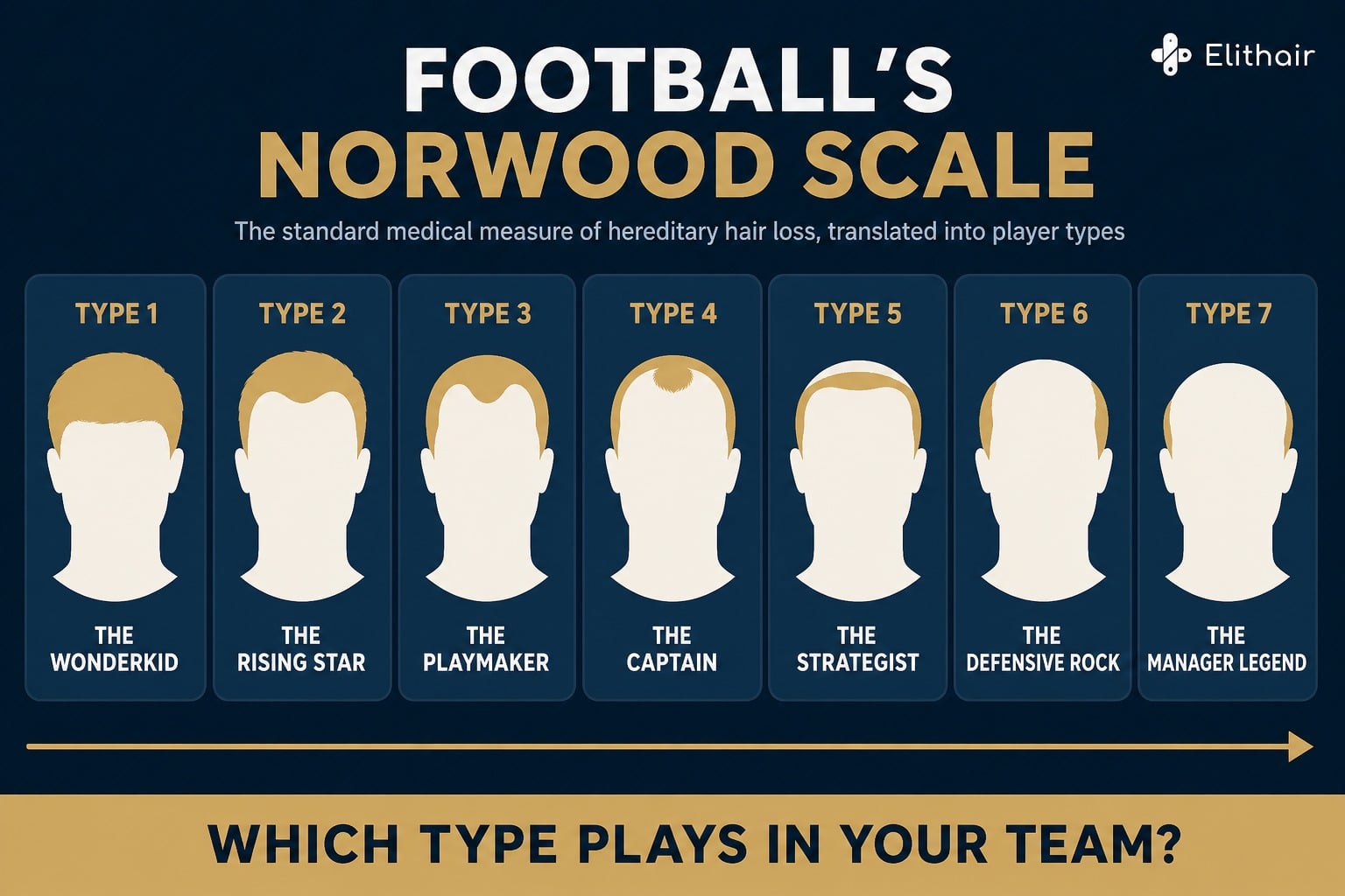Infographic: football's Norwood scale, seven player types from the wonderkid to the manager legend