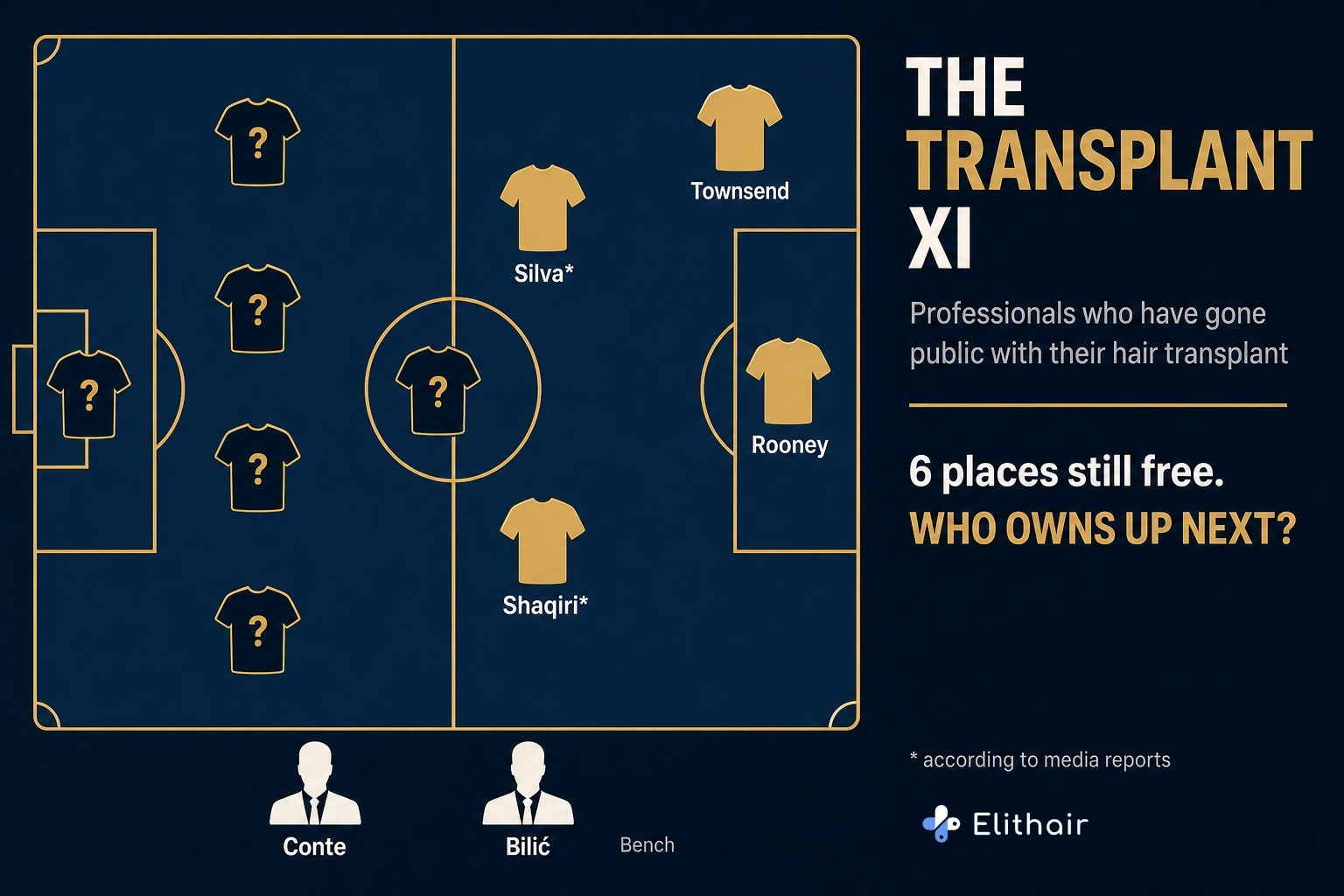 Infographic: the Transplant XI, professionals with a publicly disclosed hair transplant on the tactics board