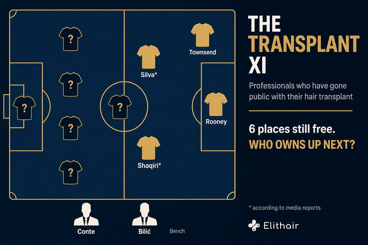 Infographic: the Transplant XI, professionals with a publicly disclosed hair transplant on the tactics board