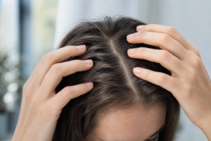 Hands parting full hair to examine a healthy scalp