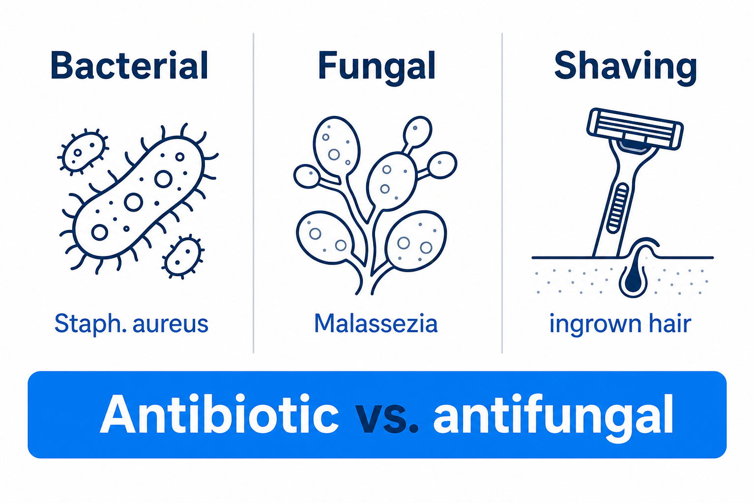 Comparison of the three most common types of folliculitis: bacterial, fungal and shaving-related