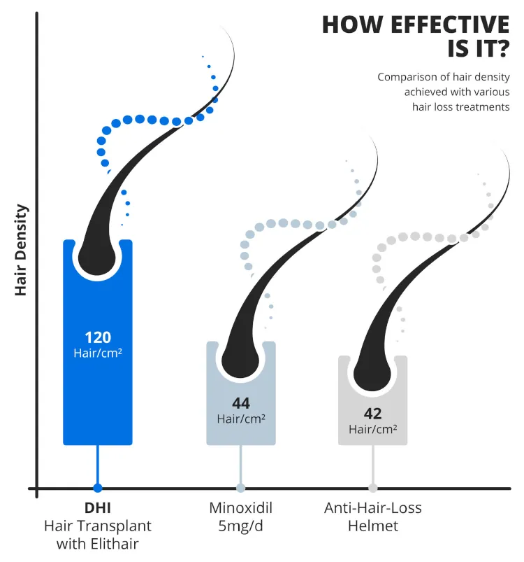 ingraphic showing the hair density obtained with different hair restoration techniques