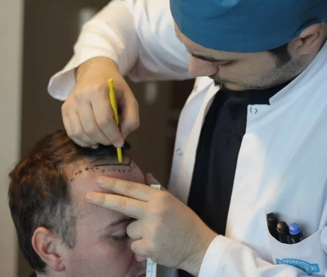 Dr. Balwi draws a thin line on a patient's face that will be the new hairline