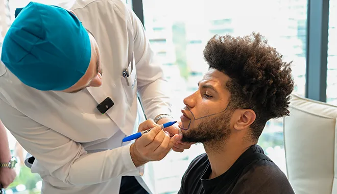 Patient receiving beard transplant with defined beardline by Dr. Balwi at Elithair showing natural and fuller beard results