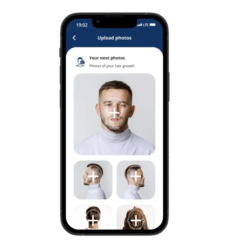 The pictures screen of the Elithair app for hair transplantation