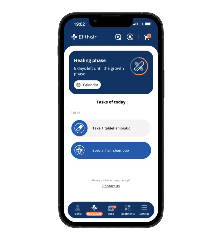 The tasks screen of the Elithair app for hair transplantation
