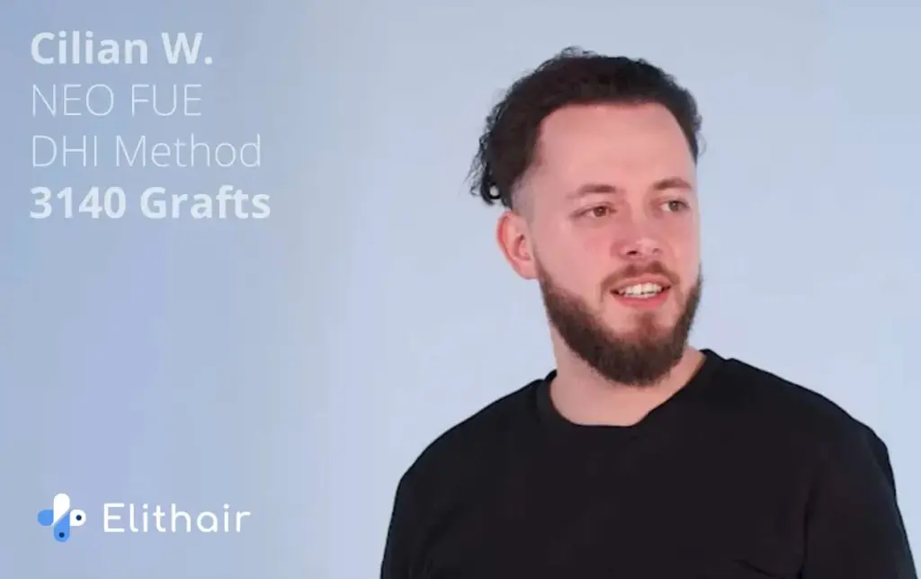Patient Cillian who had a positive hair transplant experience with Elithair showing his result
