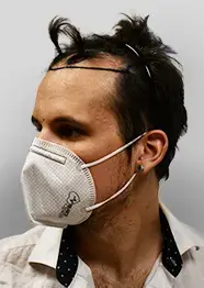 Before hair transplant of Anton showing visible hair loss and receding hairline prior to treatment