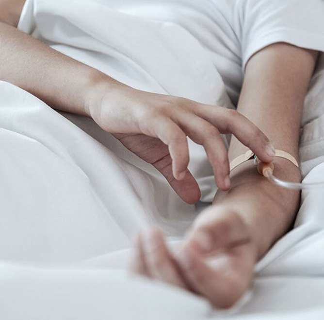Patient undergoing anesthesia with mild intravenous sedation before hair transplantation