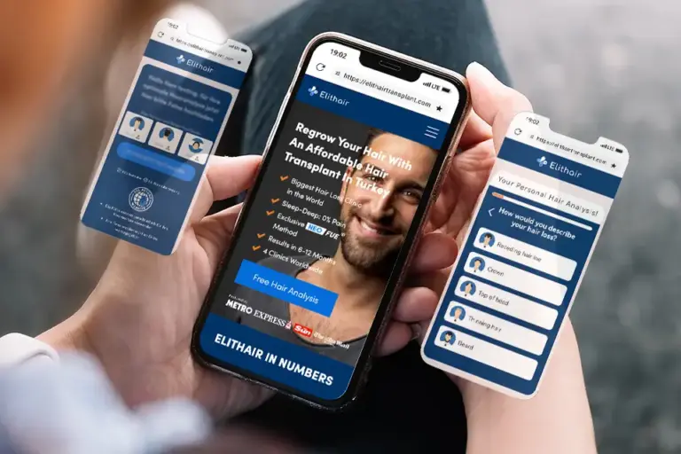 View of the Elithair app for hair analysis and post-transplant patient follow-up.