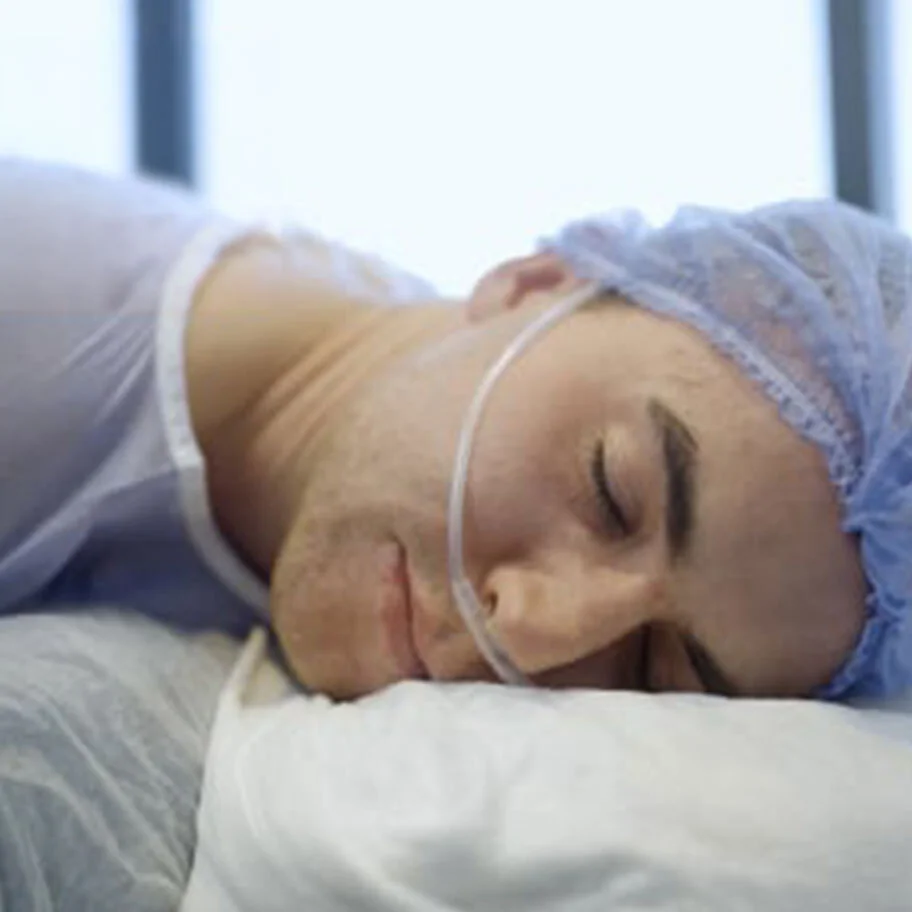 Schlafender Patient unter Sedierung während einer Behandlung. Nahaufnahme eines Mannes, der entspannt mit geschlossenen Augen auf einem weißen Kissen schläft. Er trägt eine blaue OP-Haube und eine transparente Nasenbrille zur Sauerstoffzufuhr.