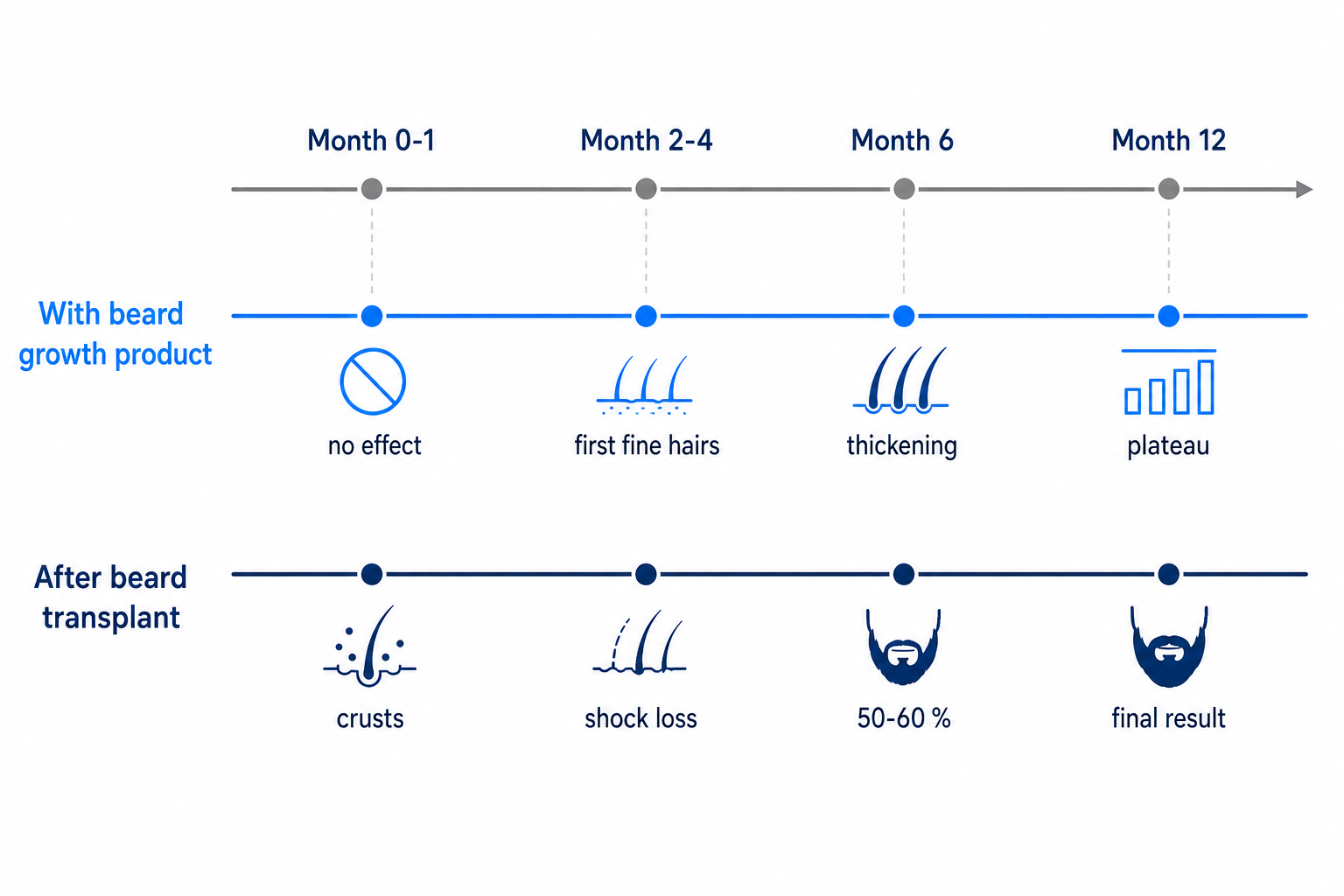 Timeline infographic of beard growth with a beard growth product compared to a beard transplant from month 0 to 12