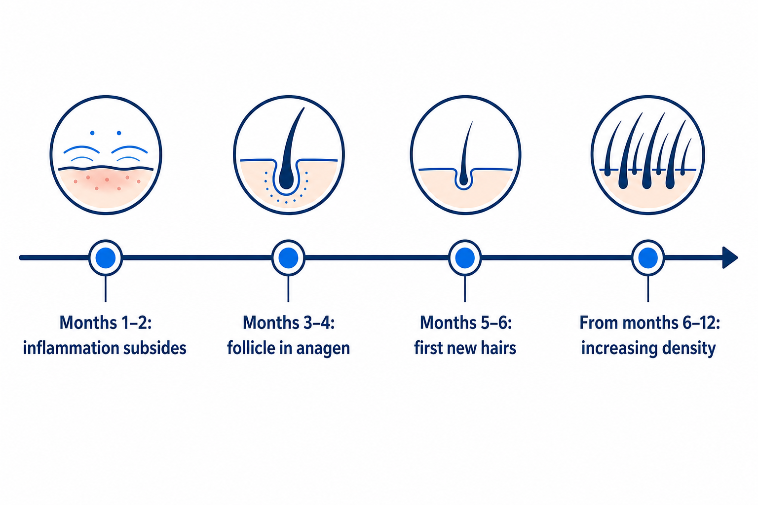 Timeline: hair regrowth after successful cortisone therapy over twelve months