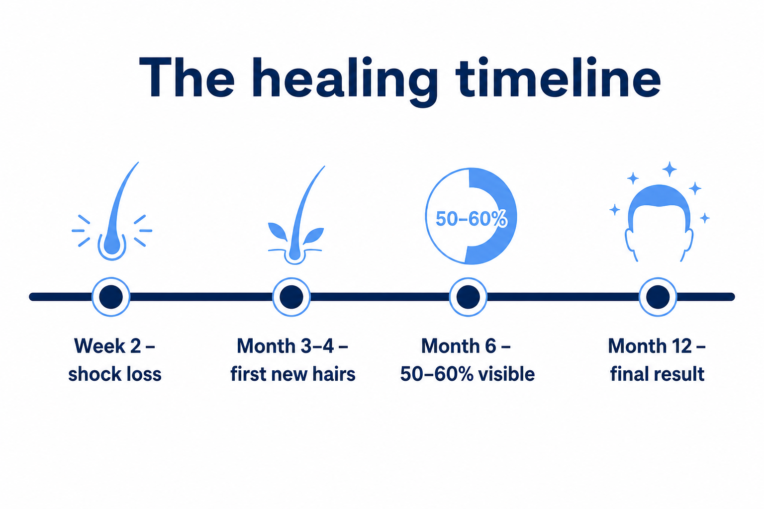 Healing timeline after a hair transplant, from shock loss to the final result after twelve months