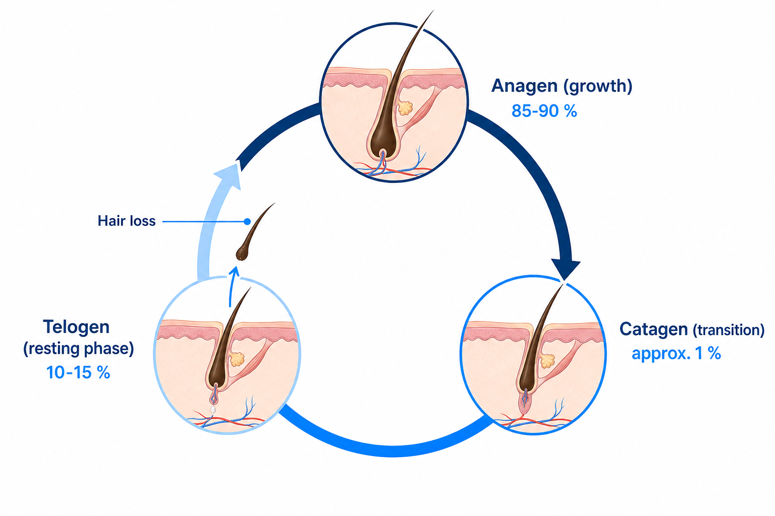 Diagram of the hair growth cycle with the anagen, catagen, and telogen phases and the point at which hair loss occurs