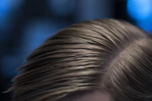 Full, healthy hair in backlight as a symbol of the interplay between hormones and hair