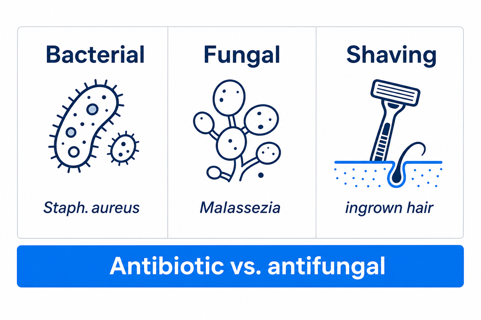 Comparison of the three most common types of folliculitis: bacterial, fungal, and shaving-related