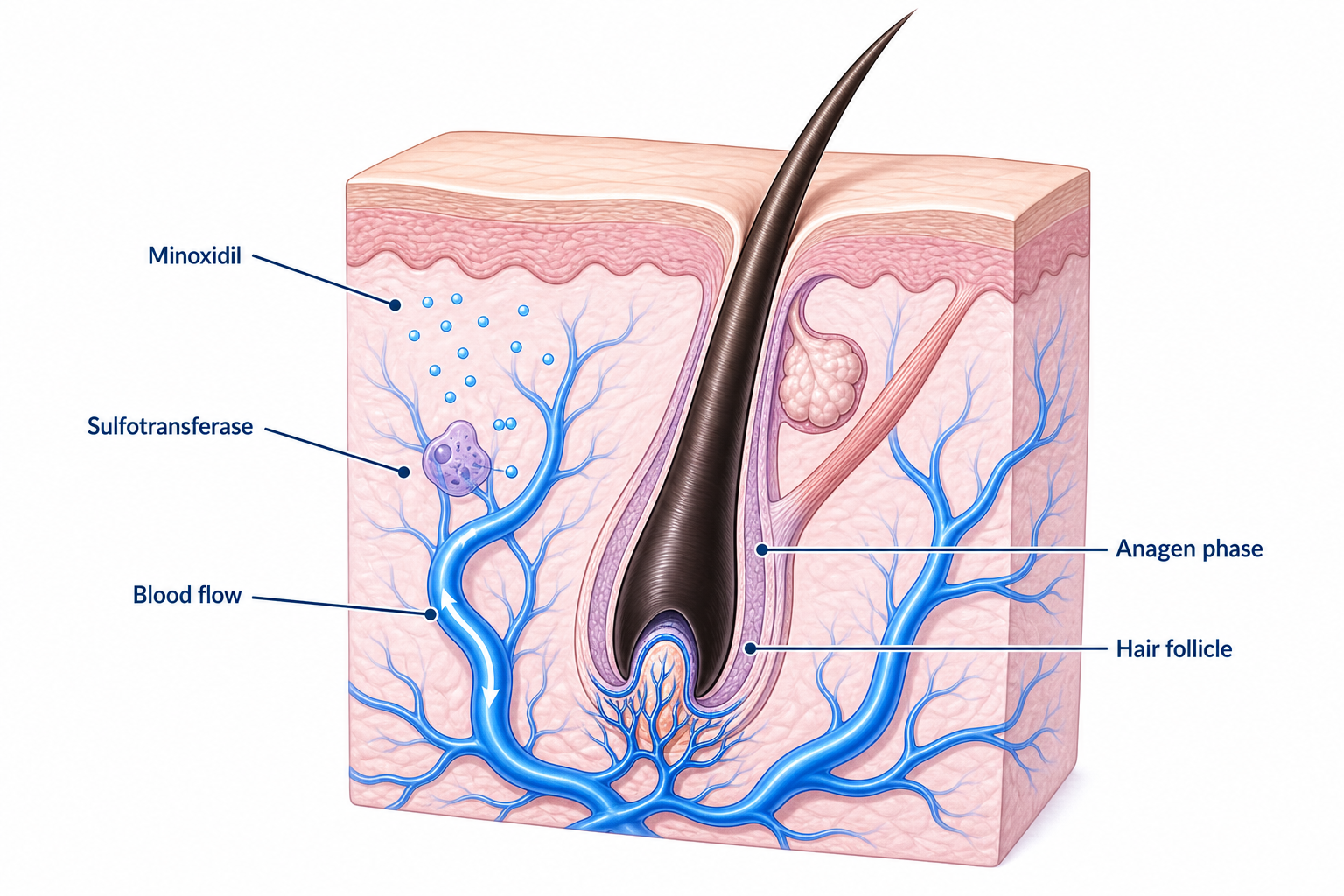 Illustration of the minoxidil mechanism of action at the hair follicle with widened blood vessels