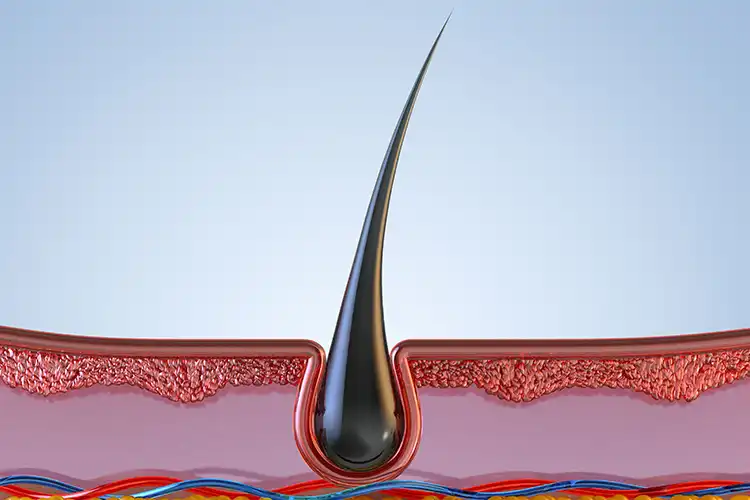 Illustration of a hair follicle in the scalp