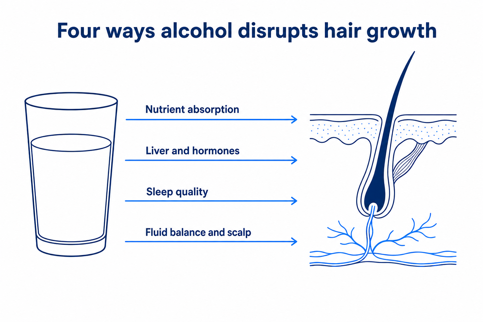 Infographic: four ways alcohol disrupts hair growth, from nutrient absorption to the scalp