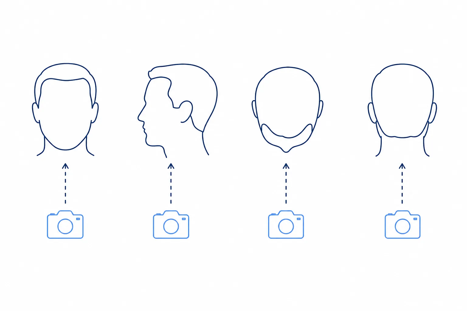 Line art of the four photo angles for the hair analysis: from the front, in profile, from above and from behind