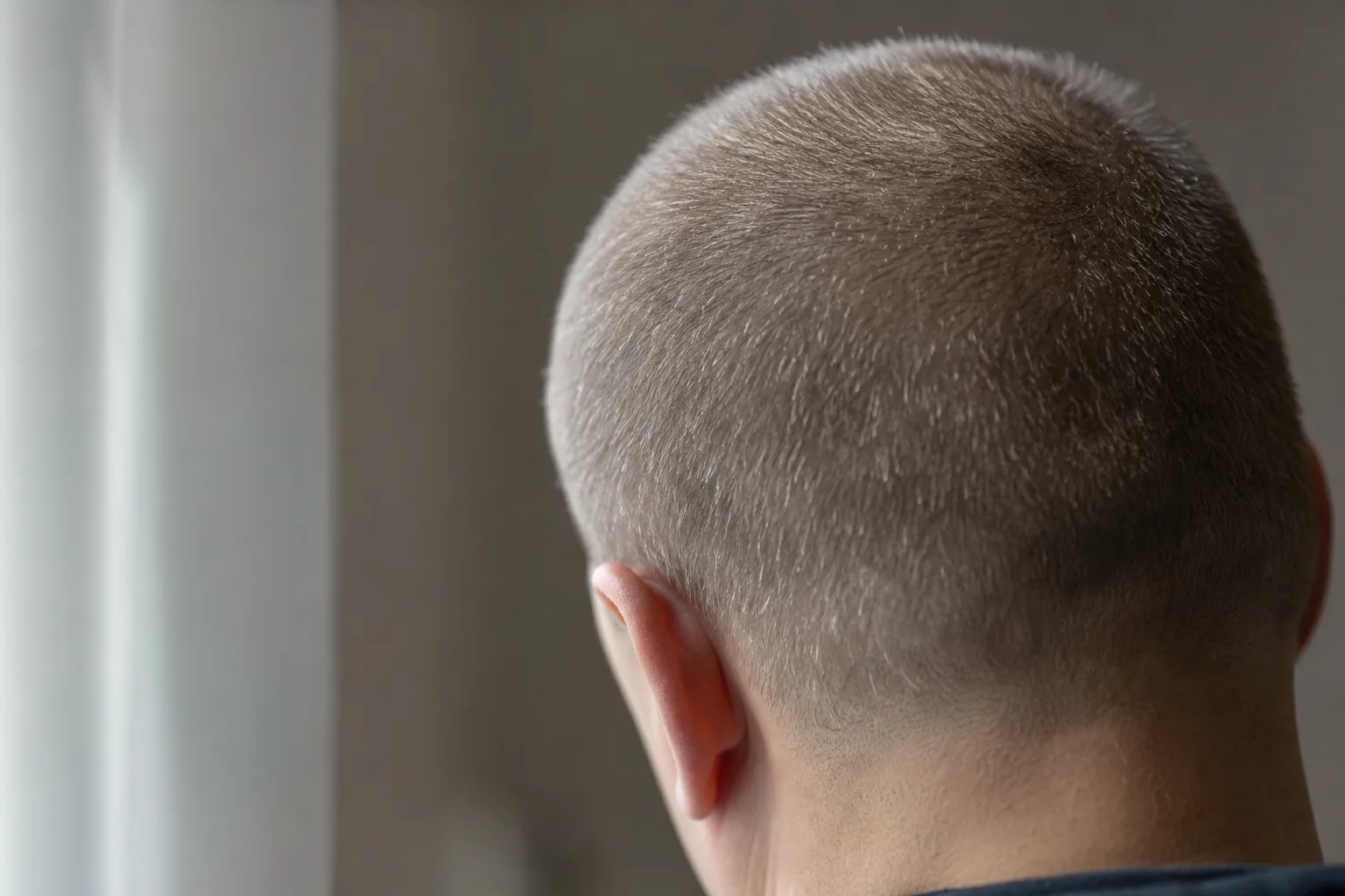 Close-up of the back of a head with very short, fine hair in soft daylight