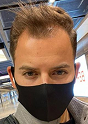 Saç ekiminden önce Marcel