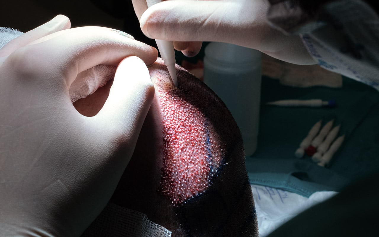 خطة علاج شاملة دون تكاليف غير متوقعة